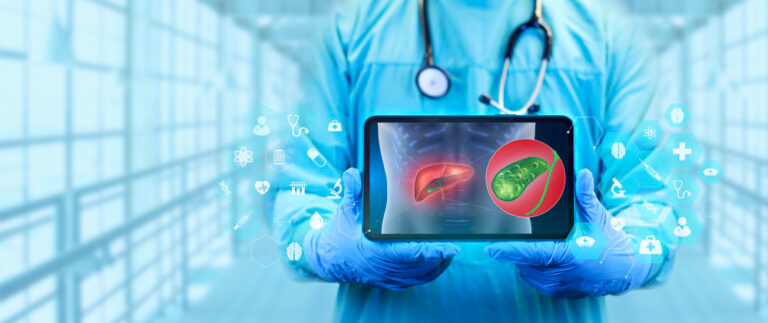 متى يستخدم التردد الحراري في علاج اورام الكبد؟ وما هي نسب نجاحه؟