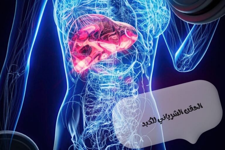 الحقن الشرياني للكبد