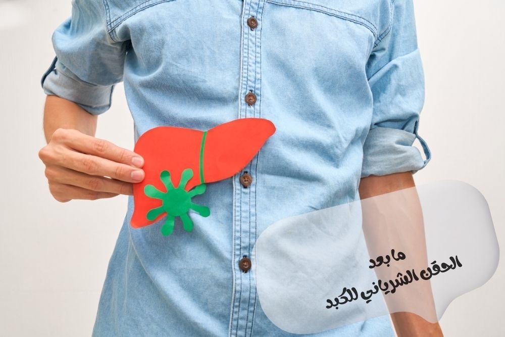 ما بعد الحقن الشرياني للكبد