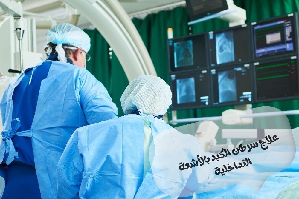 مميزات علاج سرطان الكبد بالأشعة التداخلية