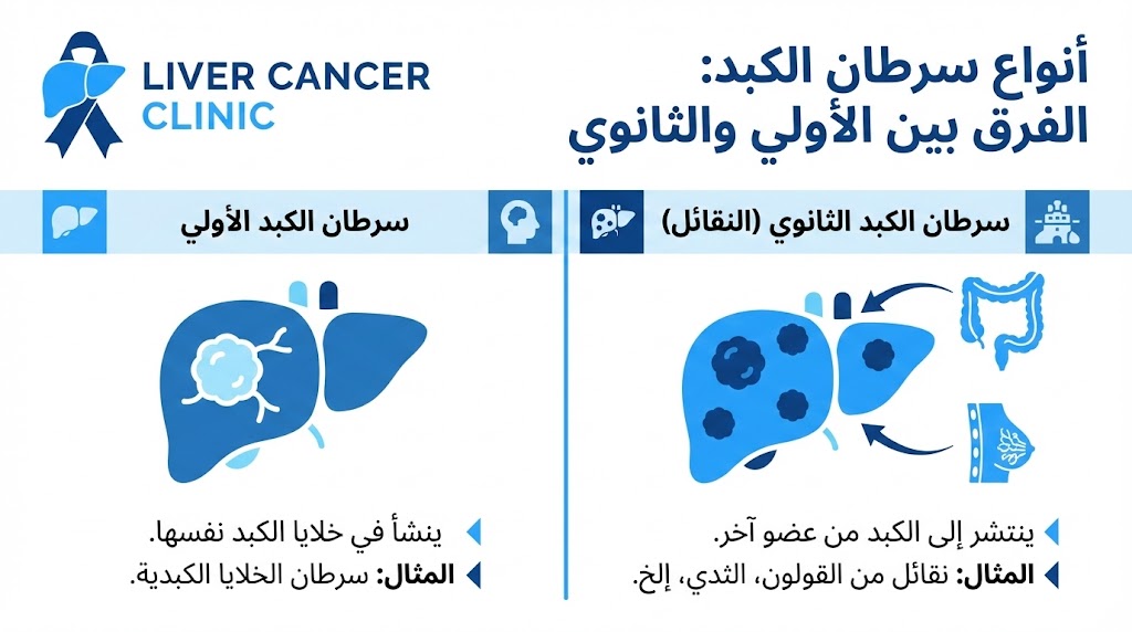 أنواع سرطان الكبد: الفرق بين الأولي والثانوي